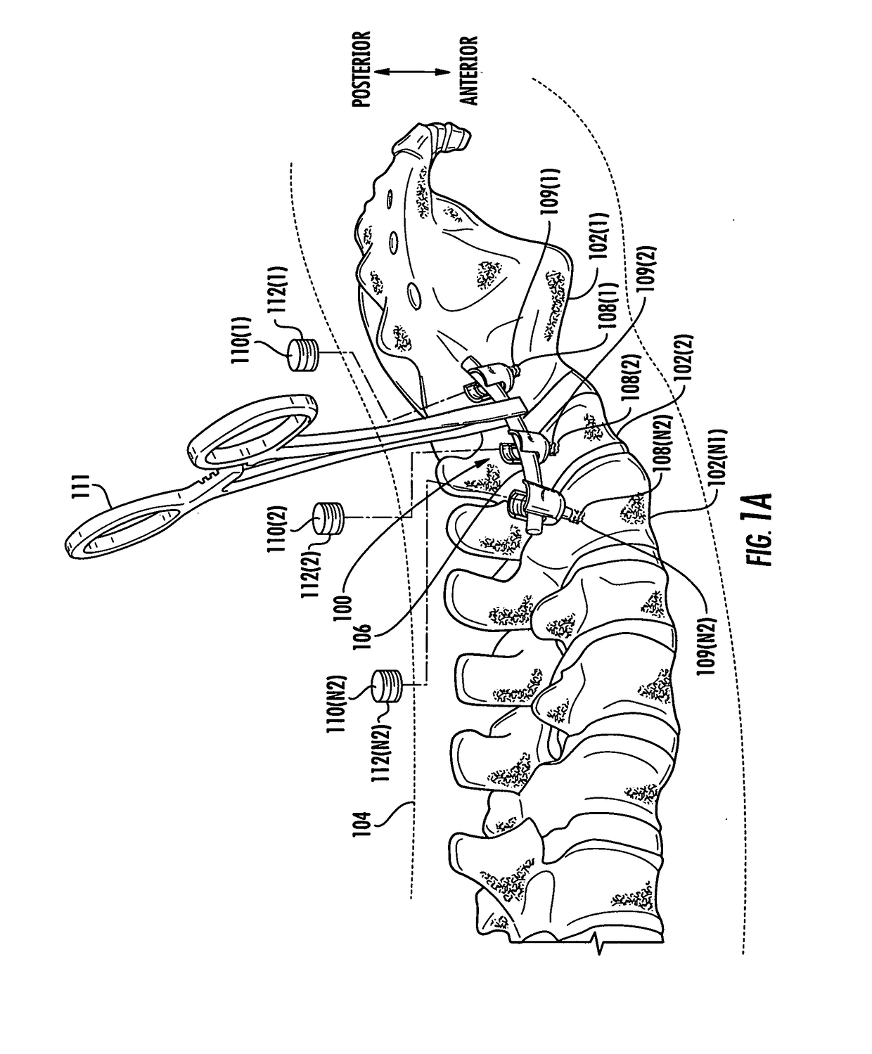 Multi-mode torque drivers employing anti-backdrive units for managing pedicle screw attachments with vertebrae, and related systems and methods