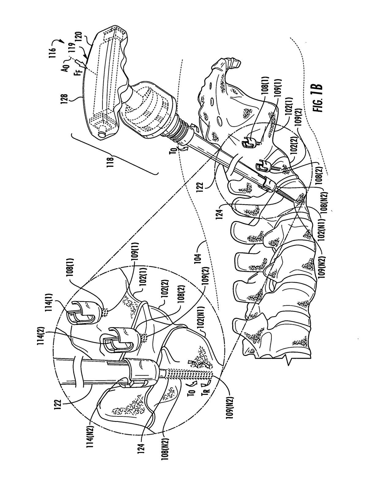 Multi-mode torque drivers employing anti-backdrive units for managing pedicle screw attachments with vertebrae, and related systems and methods