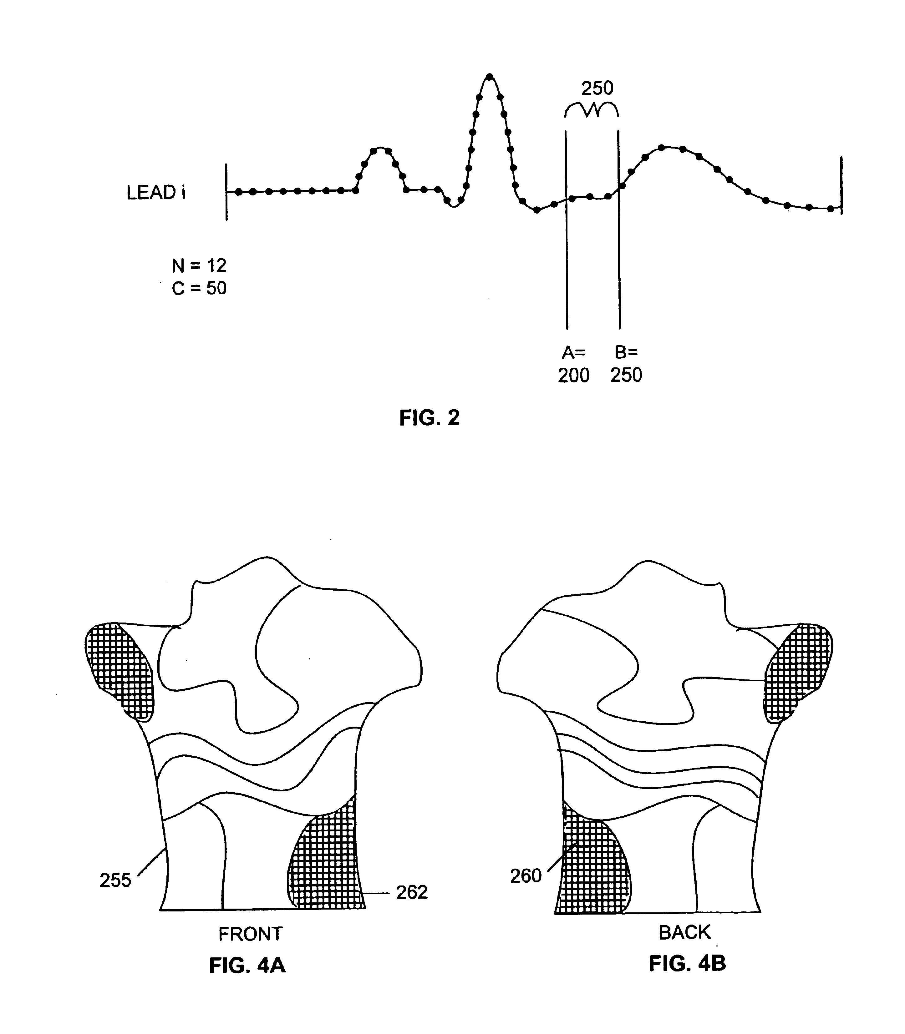 Method of and apparatus for displaying and analyzing a physiological signal