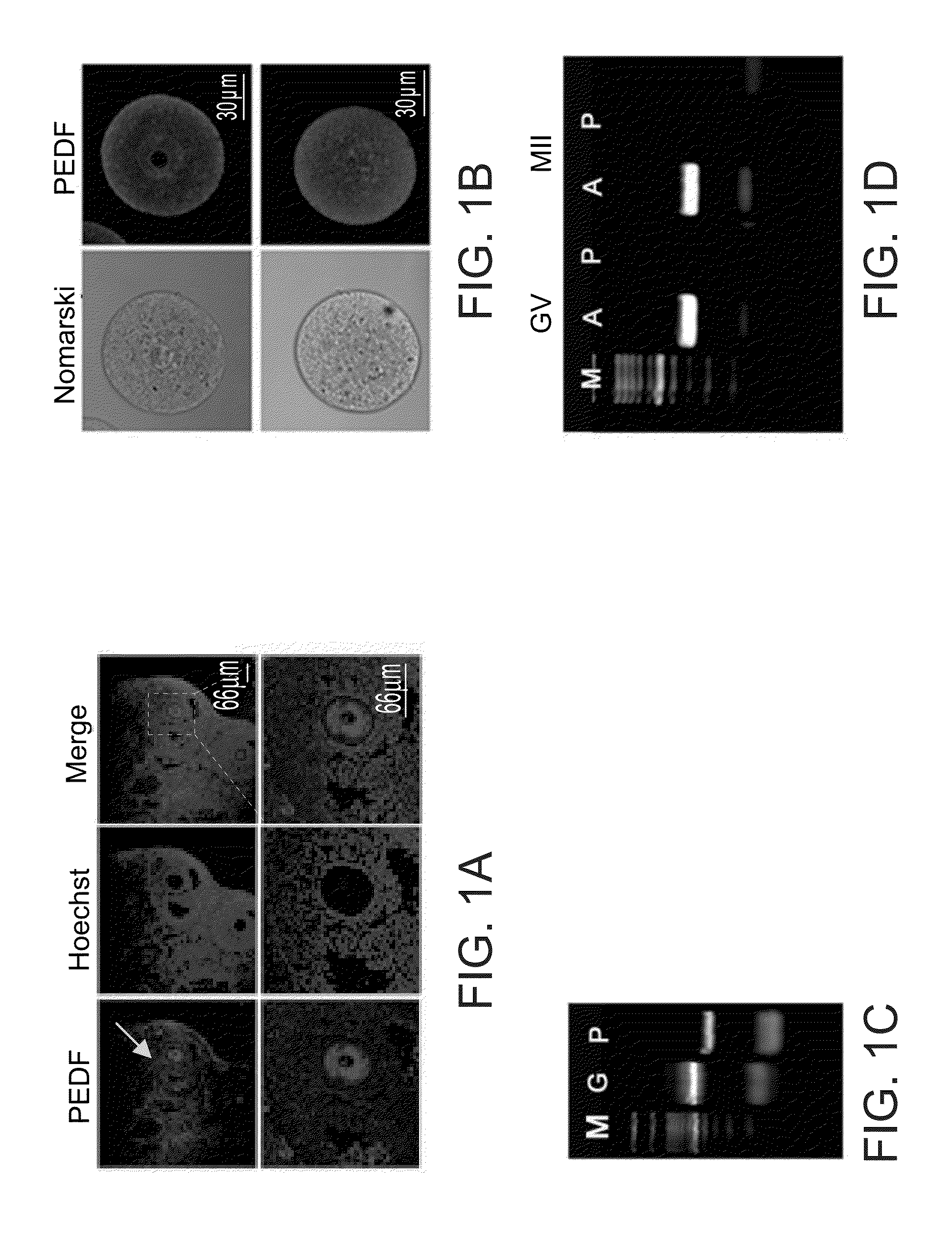 Compositions comprising PEDF and uses of same in the treatment and prevention of ovary-related syndromes