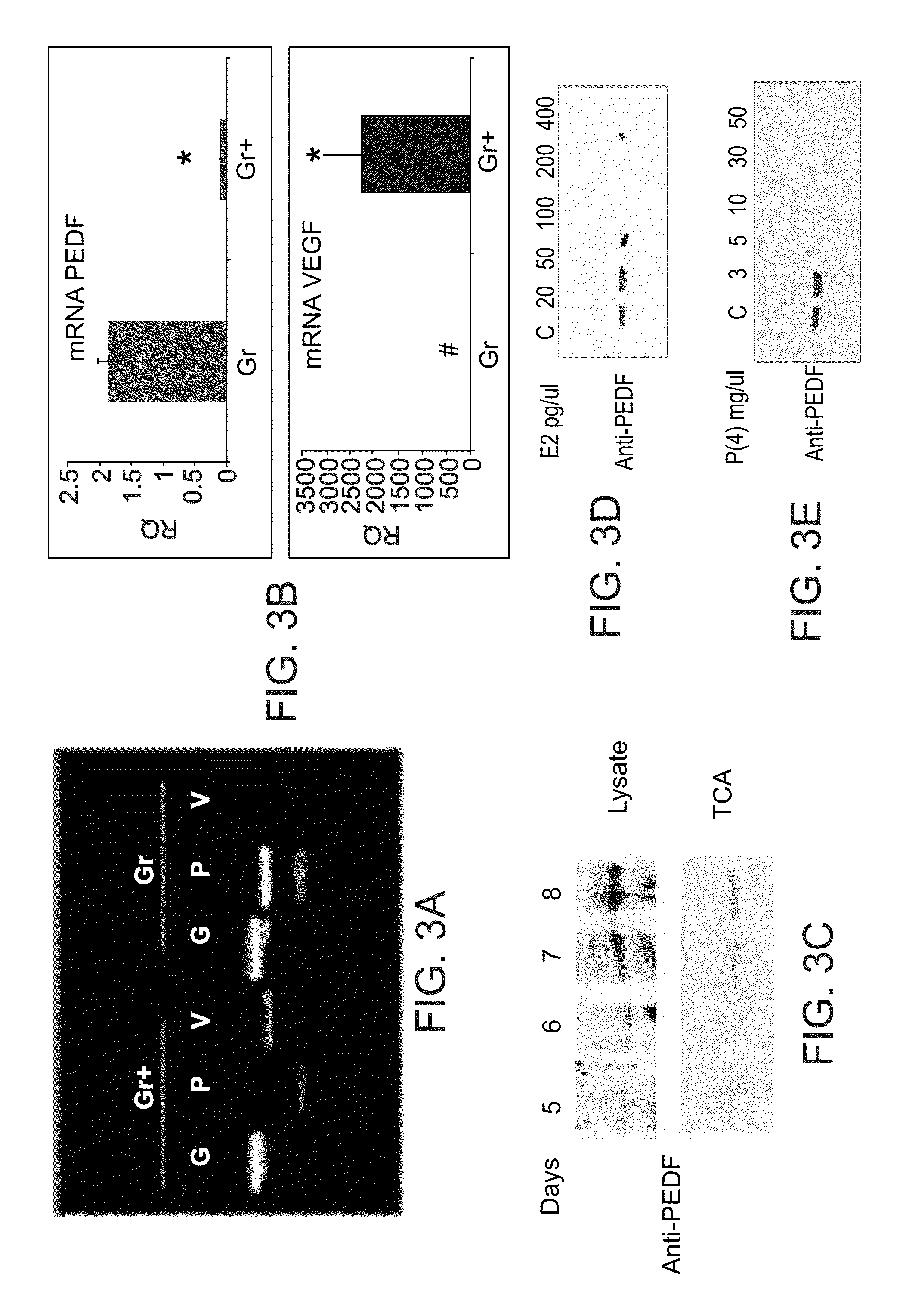 Compositions comprising PEDF and uses of same in the treatment and prevention of ovary-related syndromes