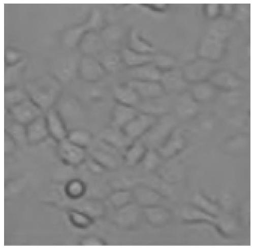 Human alveolar epithelial cell separation and culture method