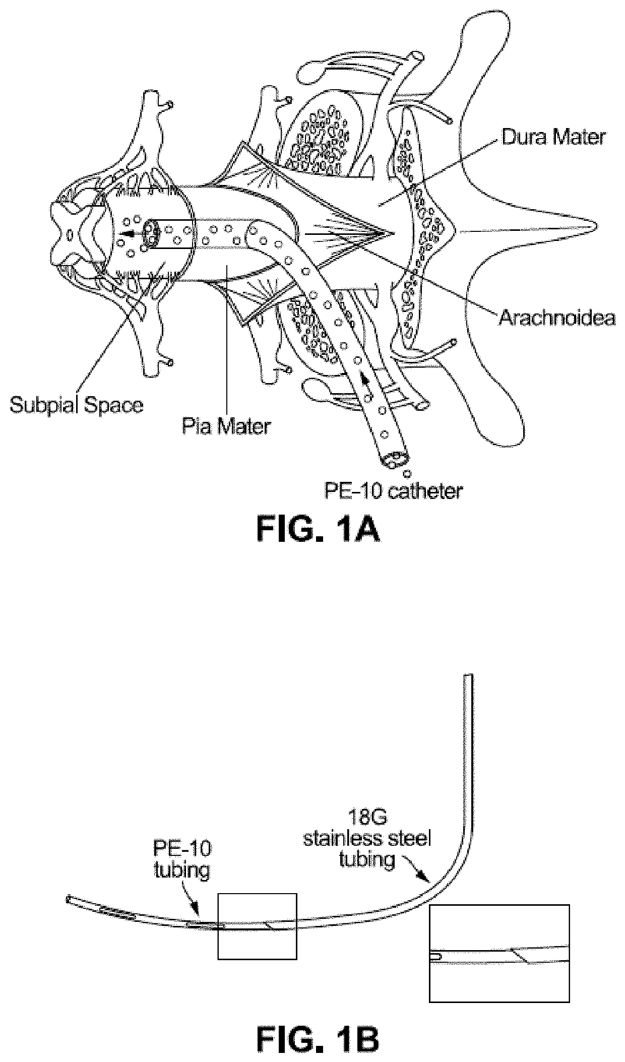 Spinal subpial gene delivery system