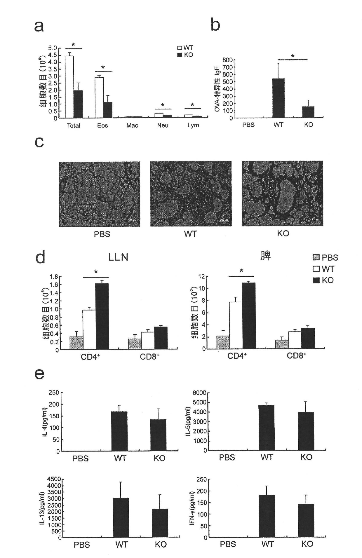 Application of extracellular matrix protein 1 and regulator thereof in preparing medicament for diagnosing or treating allergic diseases