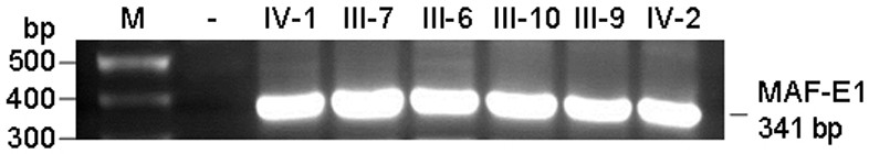 MAF gene mutant causing congenital cataract, polypeptide, kit, construct, recombinant cell and application