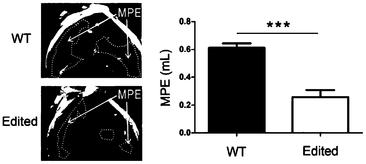 Target MYO9B related to malignant pleural effusion and application of MYO9B