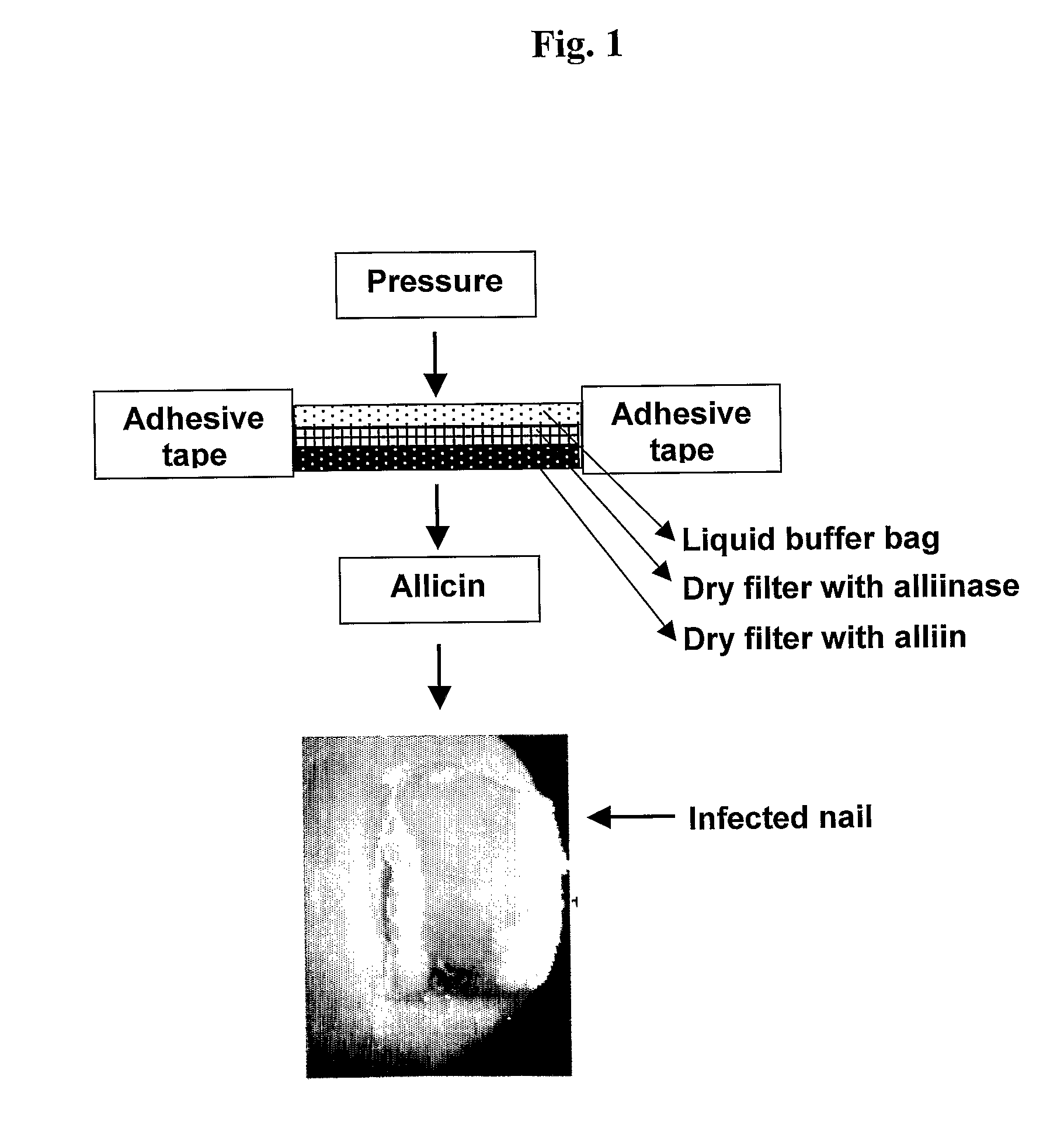 Device for in situ production and topical administration of allicin