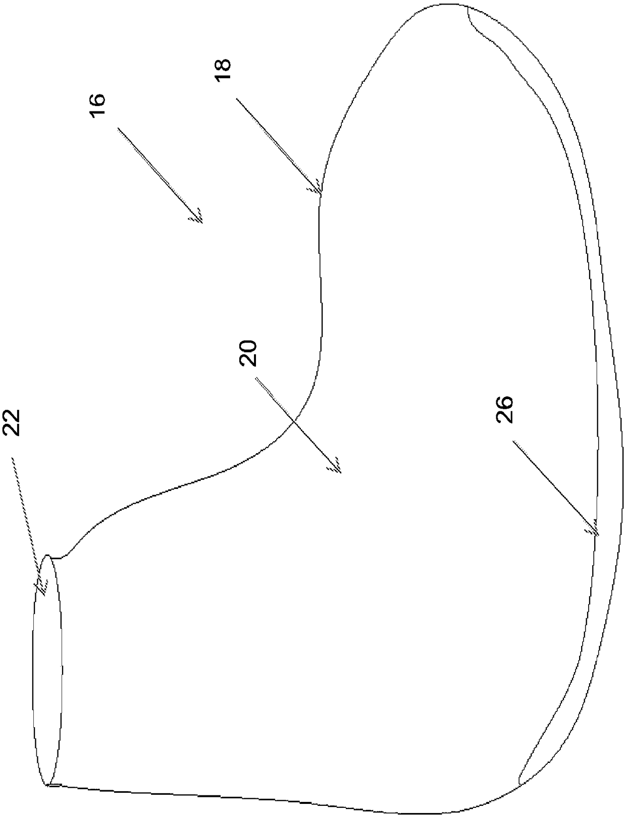 Footwear system for ulcer or pre-ulcer detection