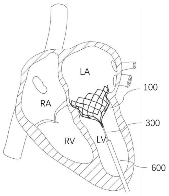 Valve prosthesis device implanted into heart