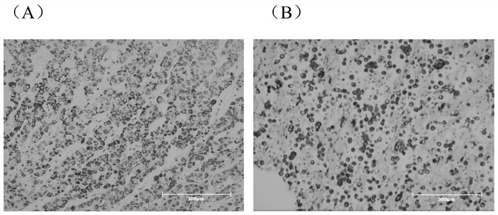 Primary hepatoma carcinoma cell culture medium, primary hepatoma carcinoma cell culture method and application