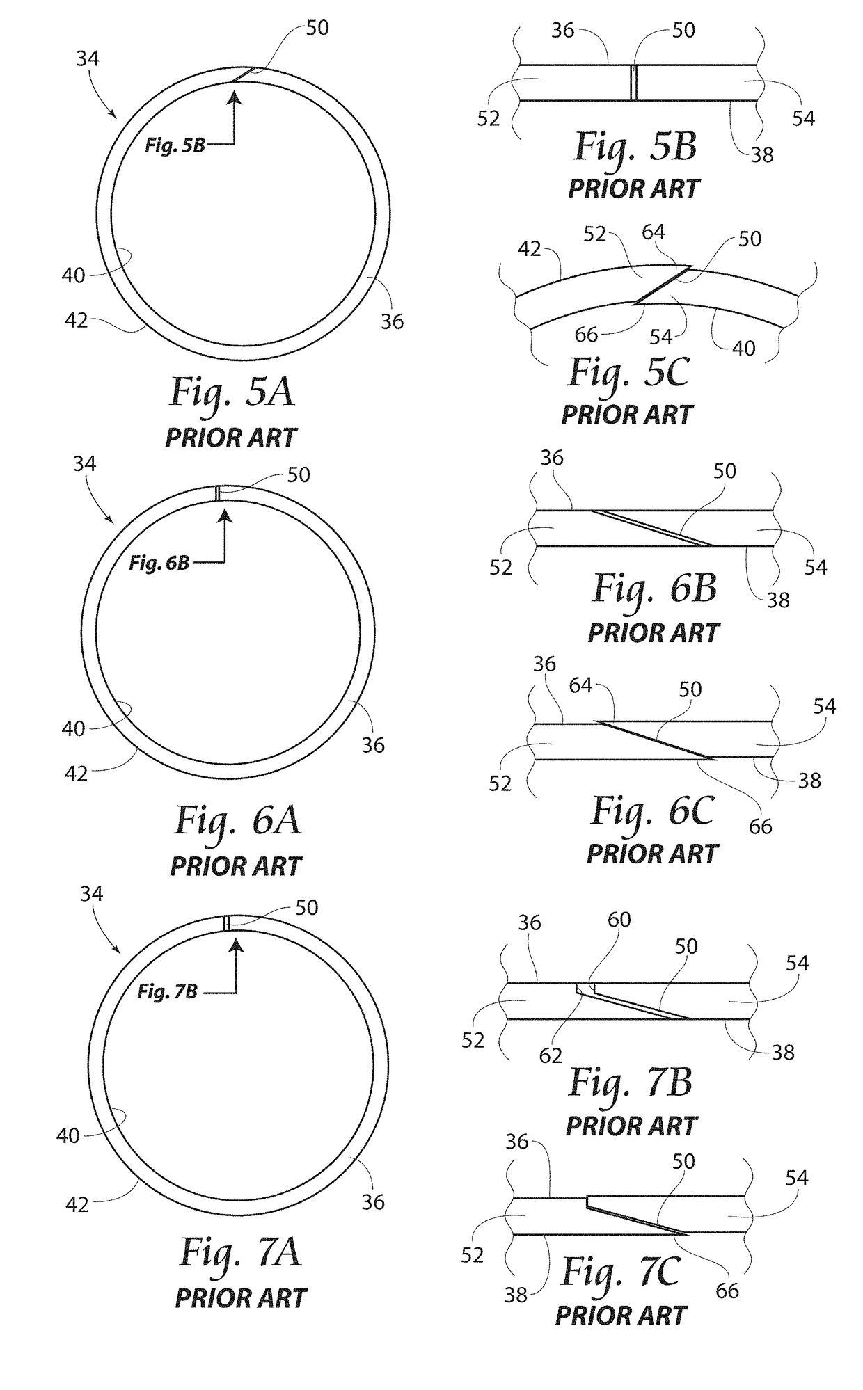 Apparatus for Preventing Extrusion and Method of Manufacturing an Anti-Extrusion Ring