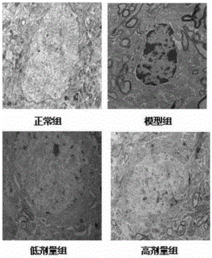 Traditional Chinese medicine composition for treating parkinson disease