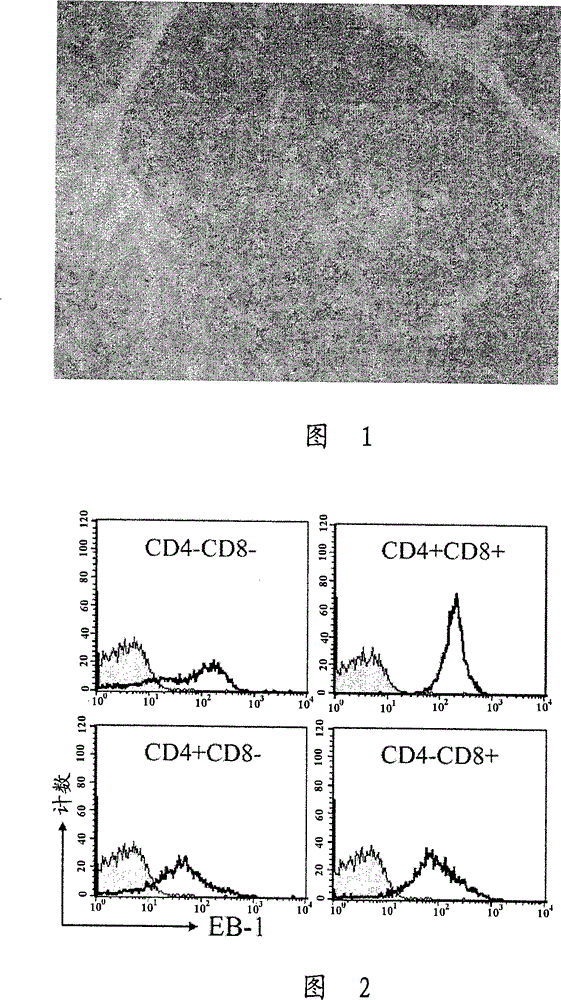 Acute leukemia and lymphoblastic lymphoma-specific CD43 epitope and use thereof