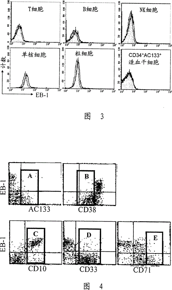 Acute leukemia and lymphoblastic lymphoma-specific CD43 epitope and use thereof