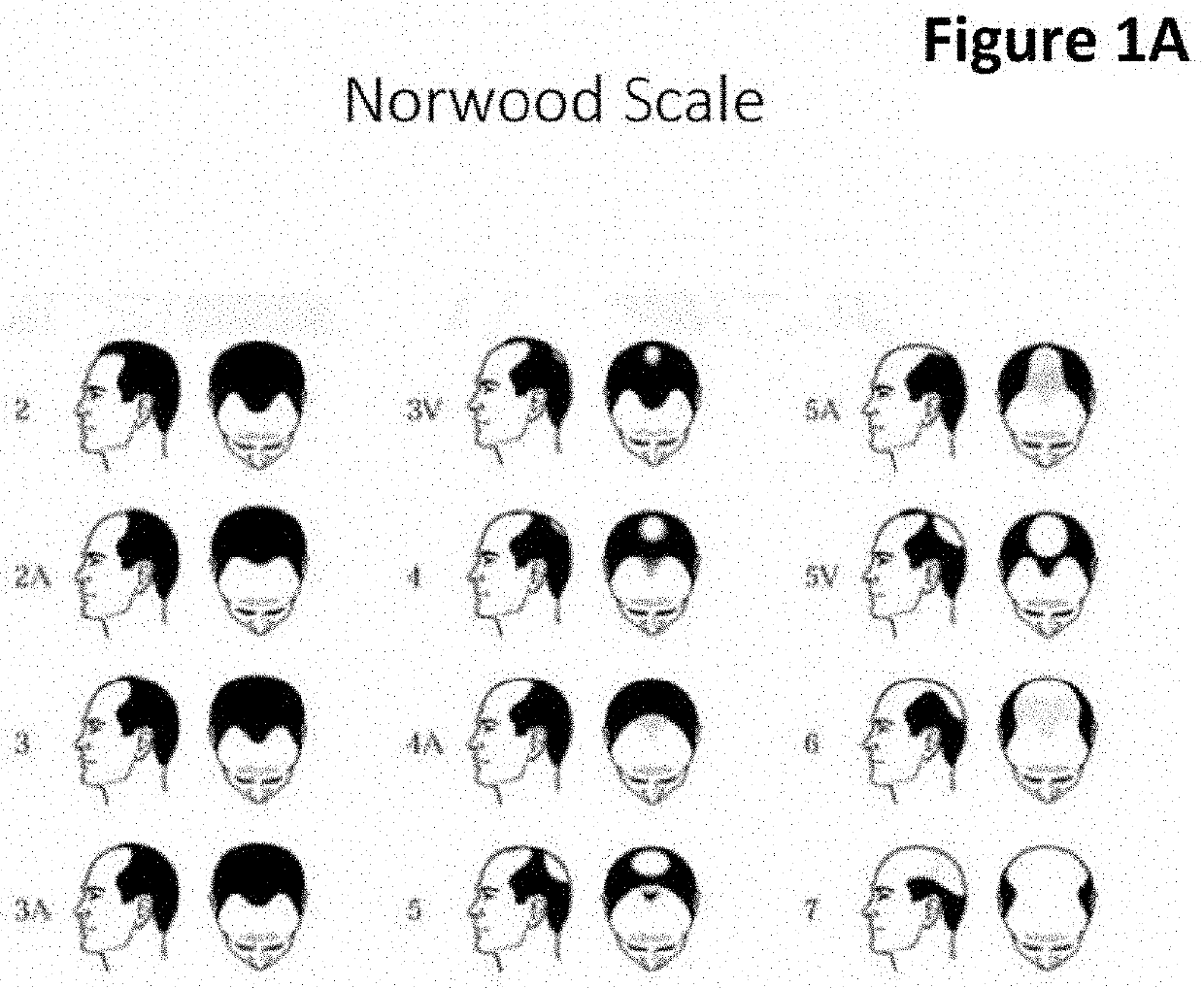 Antibody for hair improvement use