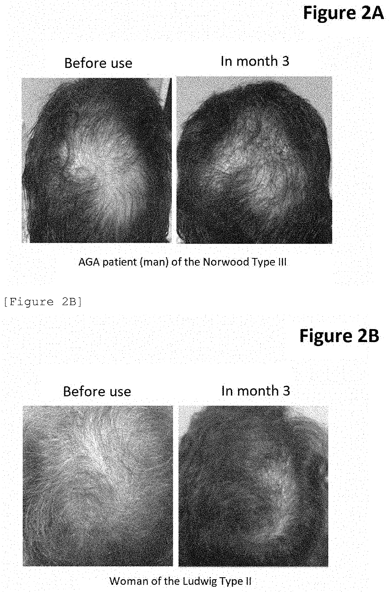 Antibody for hair improvement use