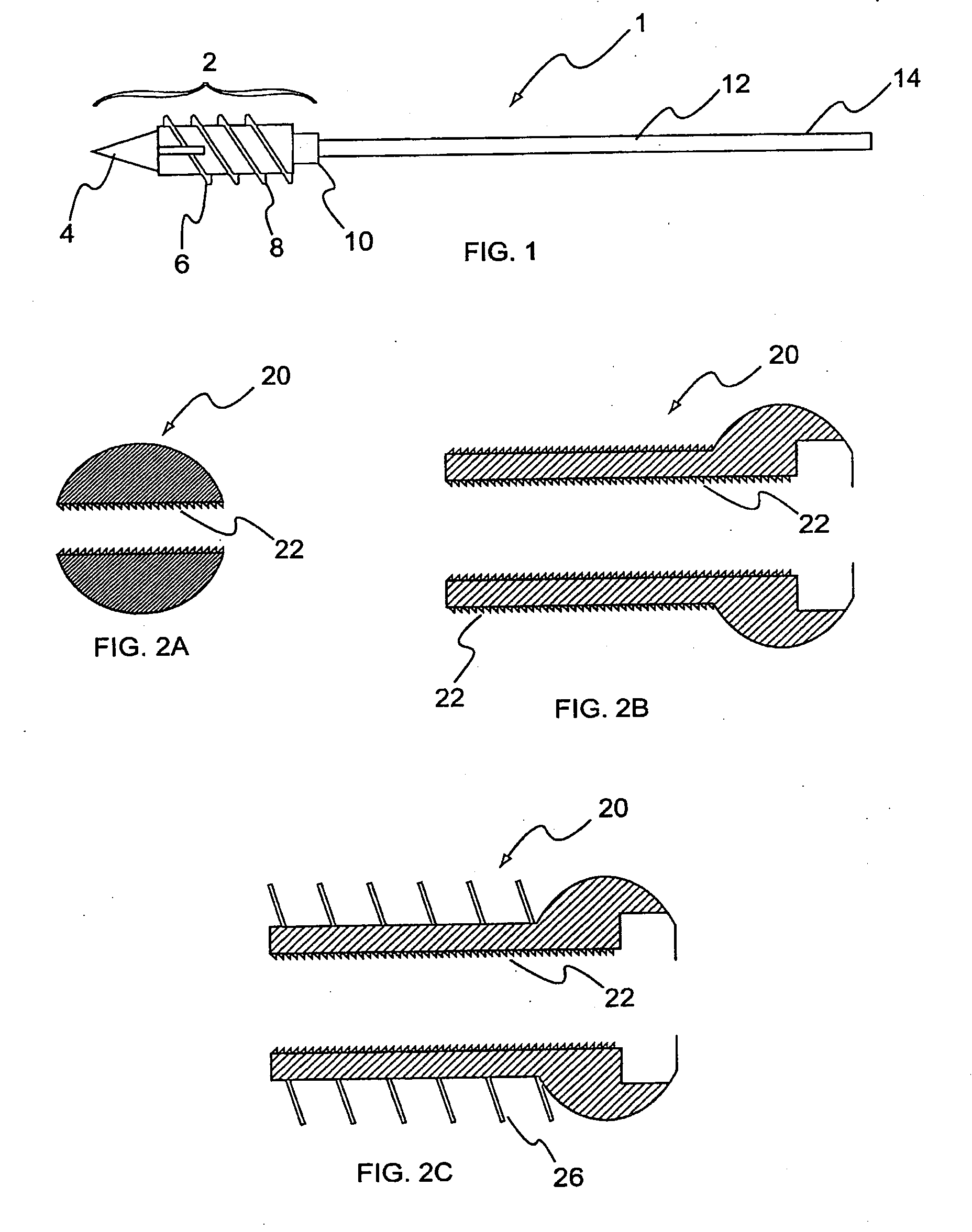 Method for the fixation of bone structures