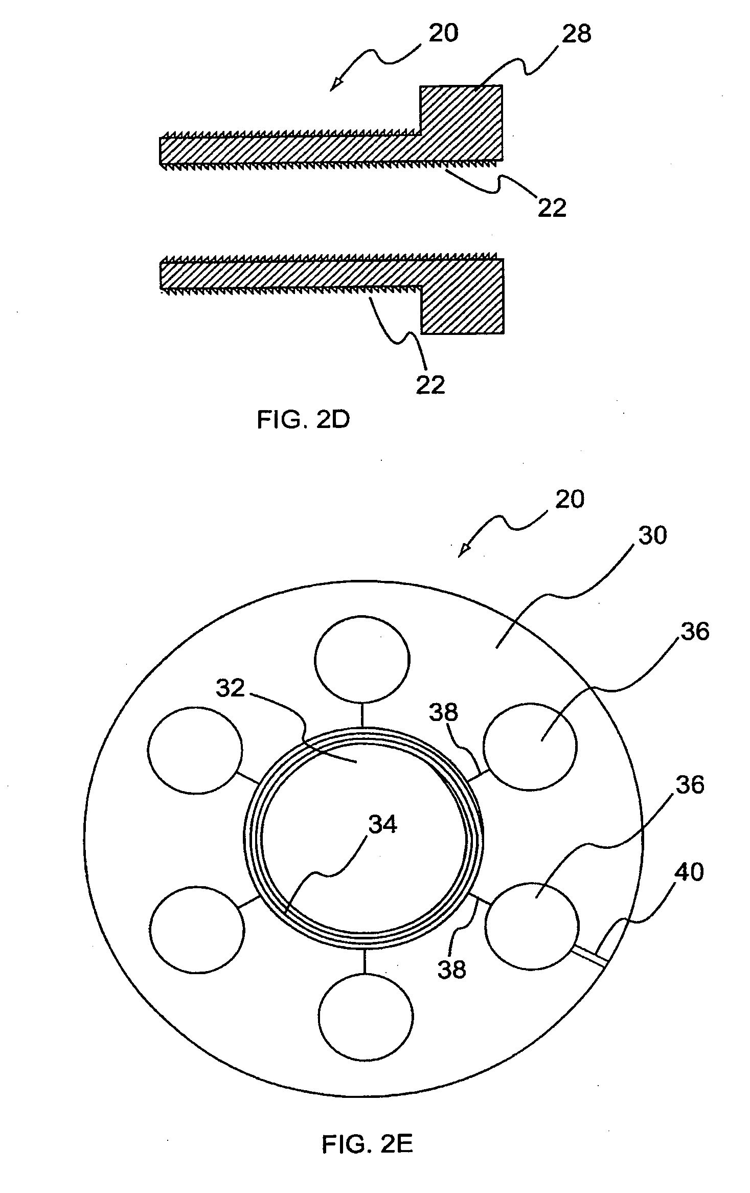 Method for the fixation of bone structures