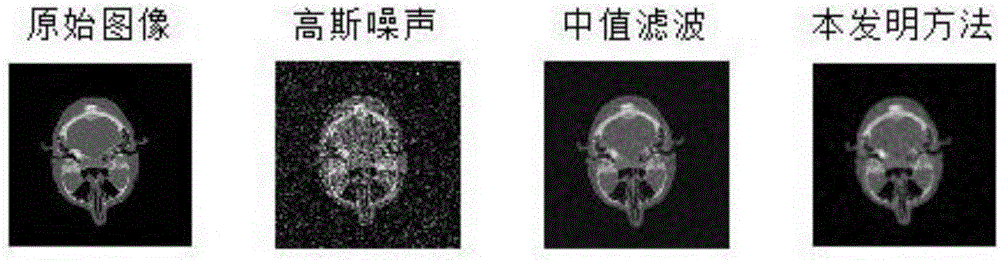 Improved adaptive weighted average image denoising method based on extreme learning machine