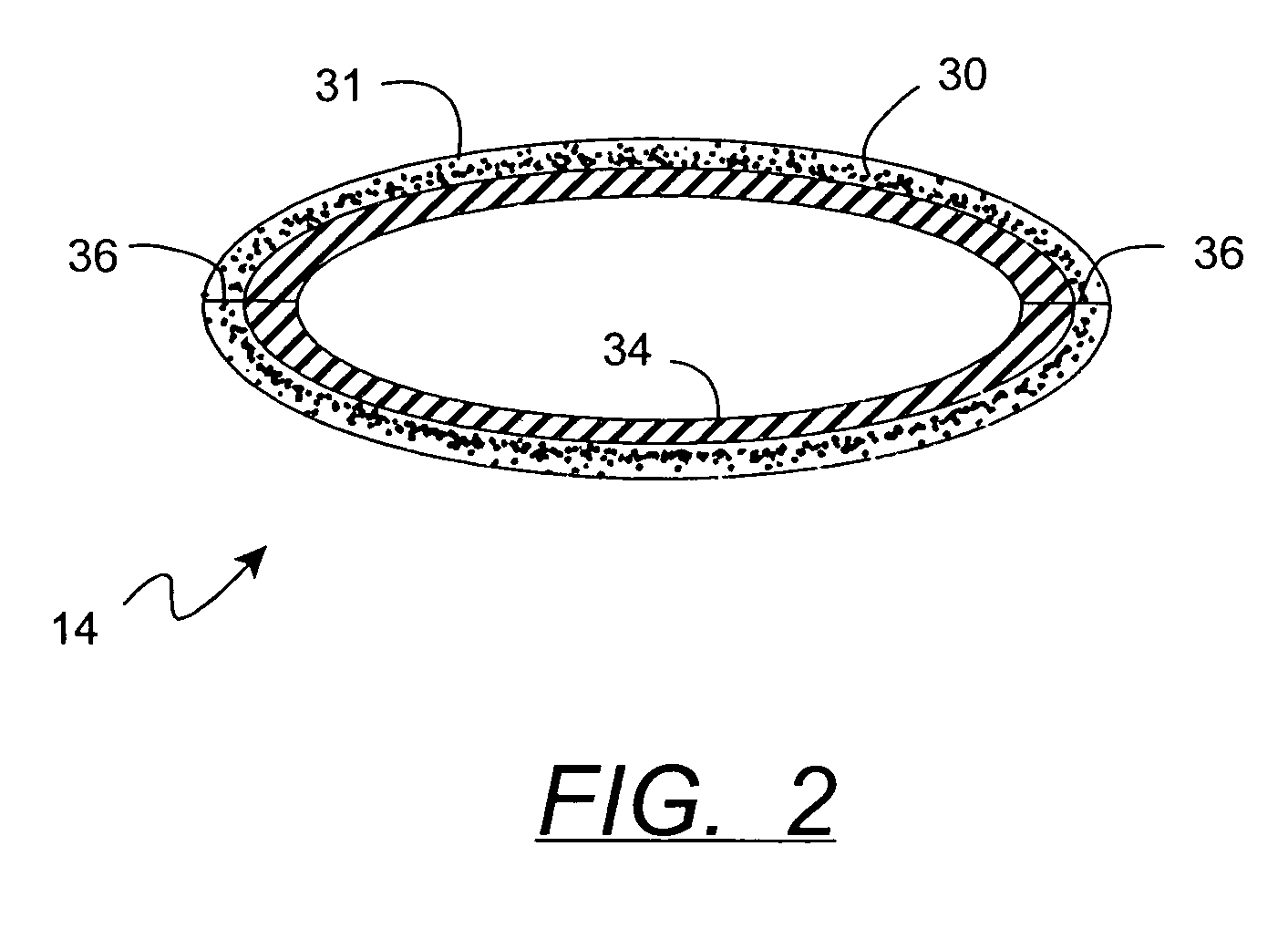 Applicator glove for application of staining compositions and self-tanning kit including same