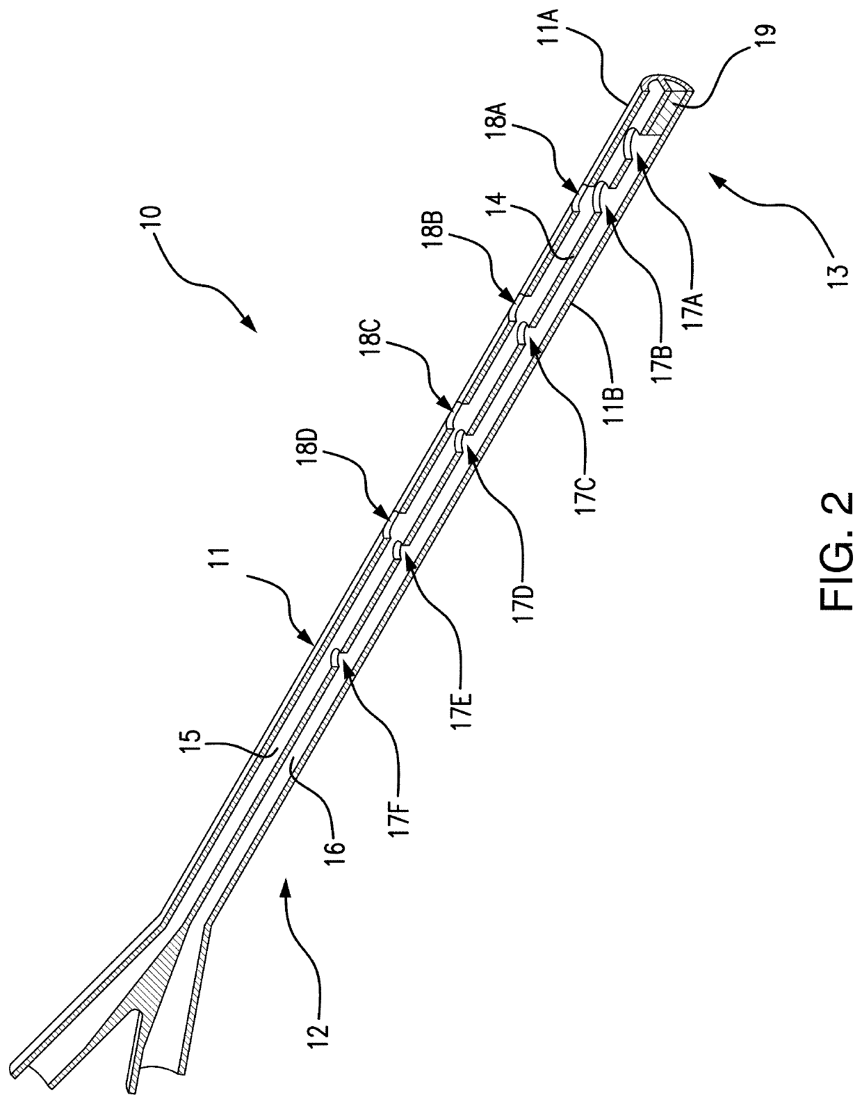 Systems and methods for percutaneous drainage