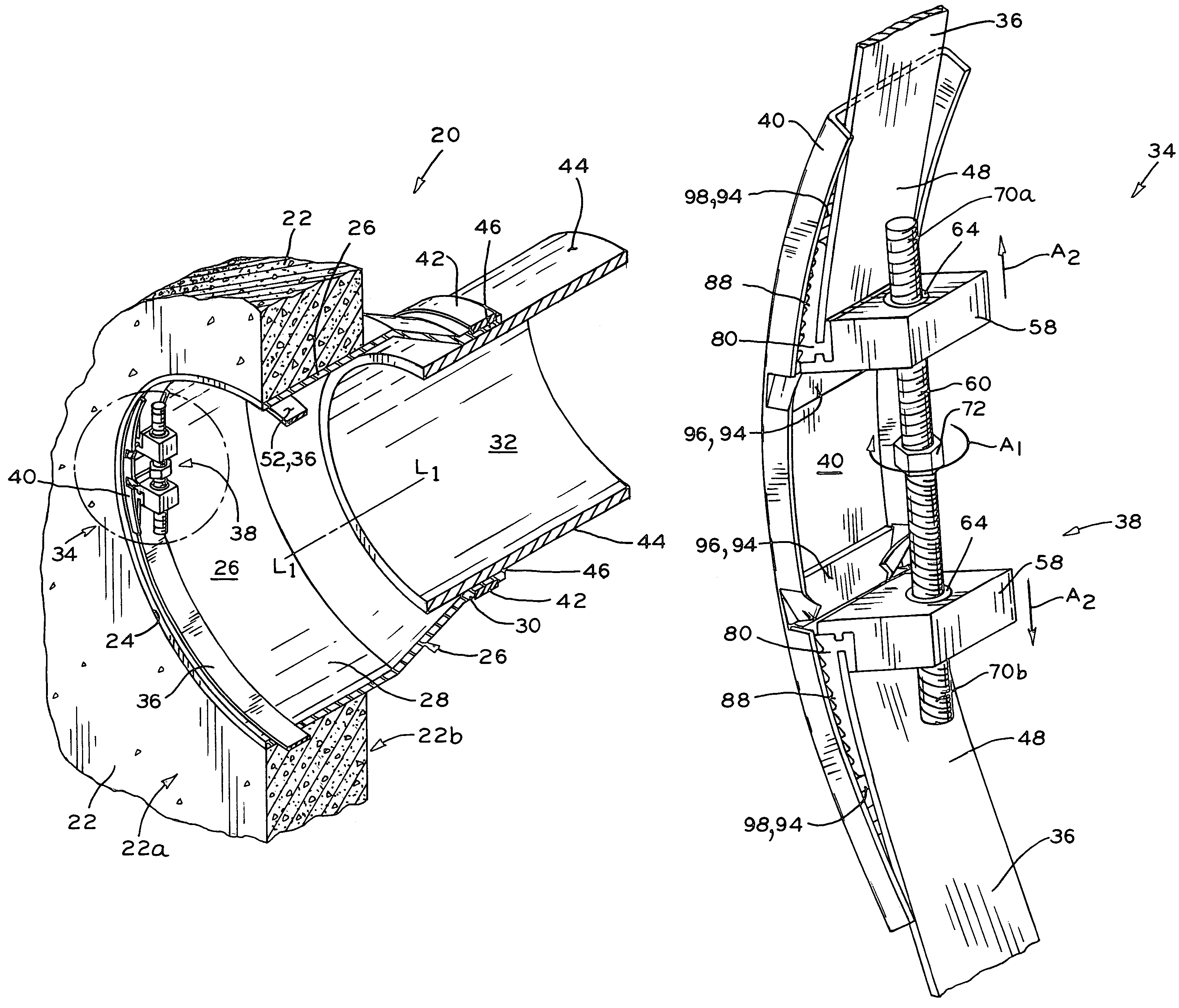 Expansion ring assembly with removable drive mechanism