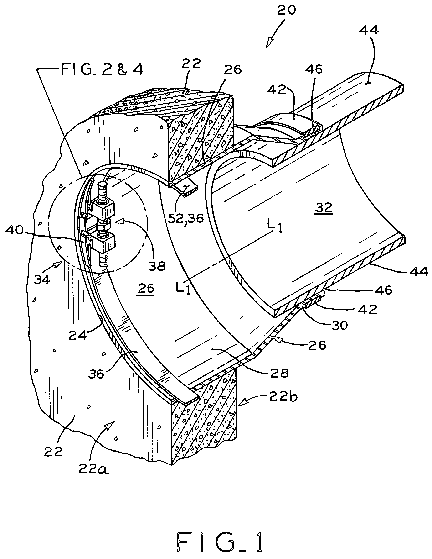 Expansion ring assembly with removable drive mechanism