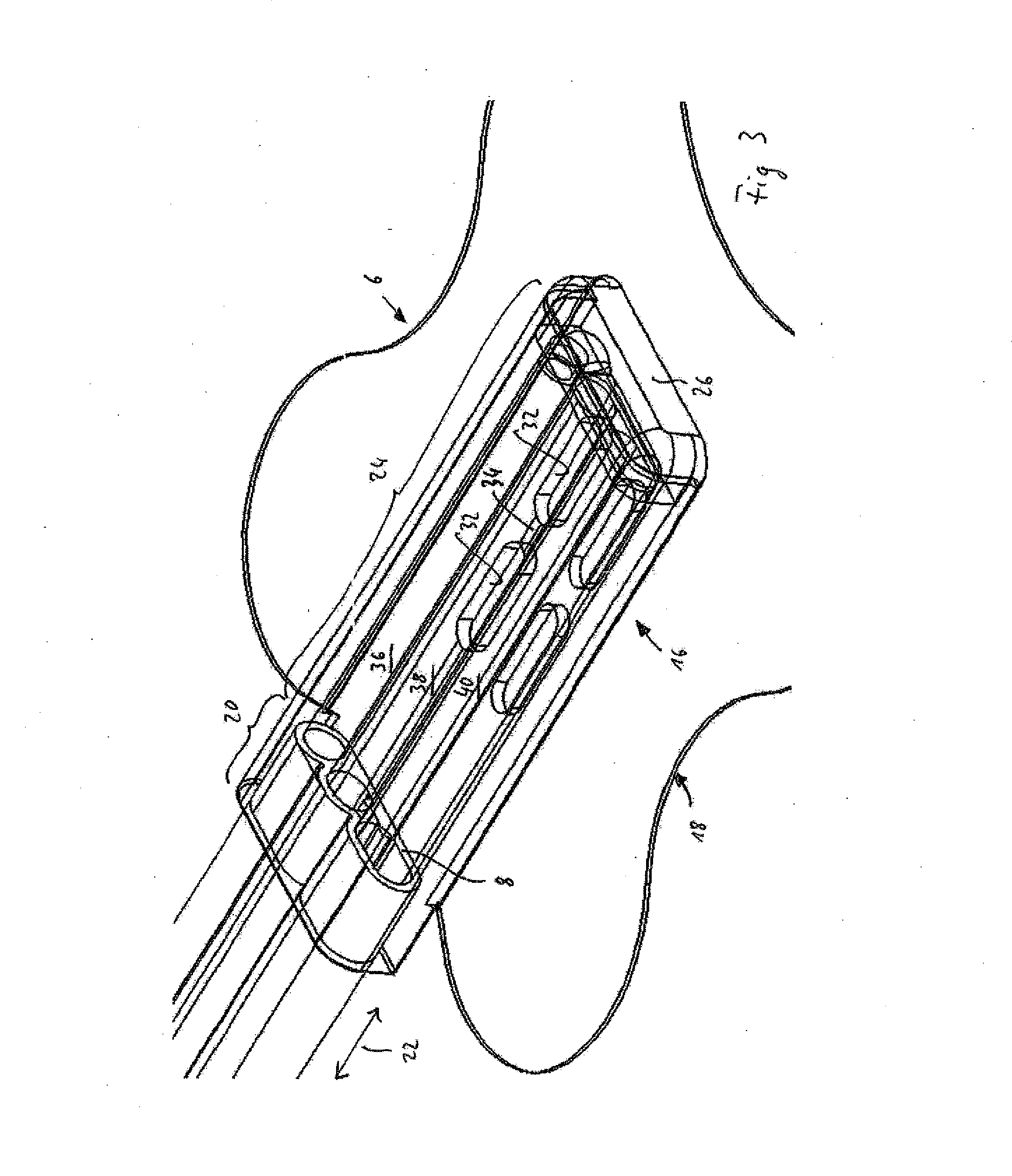Connection device for use in the negative pressure treatment of wounds