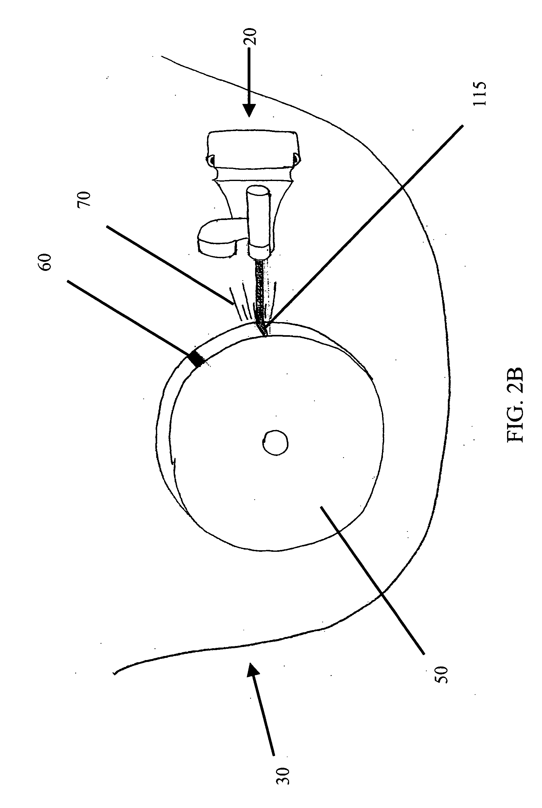 Precision timing light for internal combustion engine and method of use