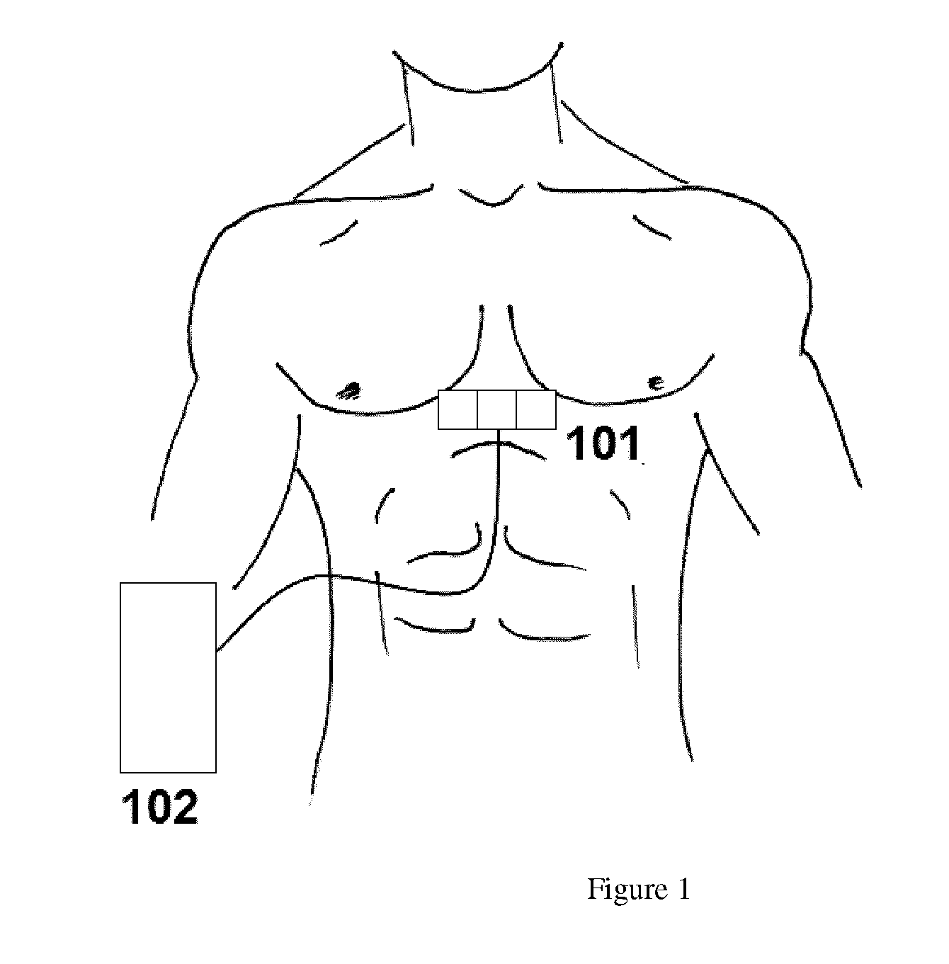 Method and apparatus for estimating myocardial contractility using precordial vibration