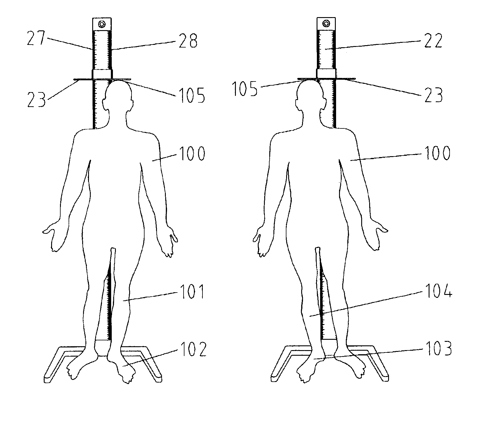 Method and apparatus for leg length discrepancy measurement