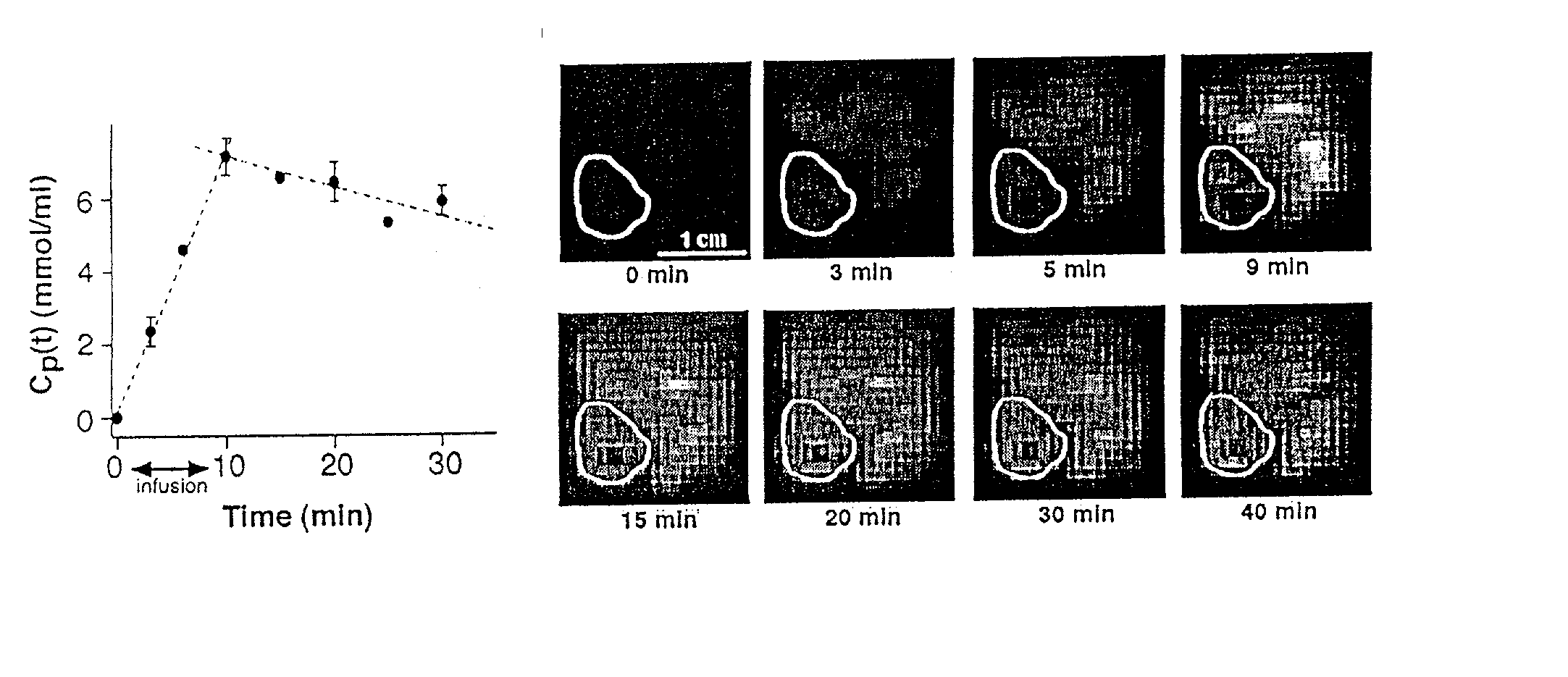 Method and apparatus for monitoring and quantitatively evaluating tumor perfusion