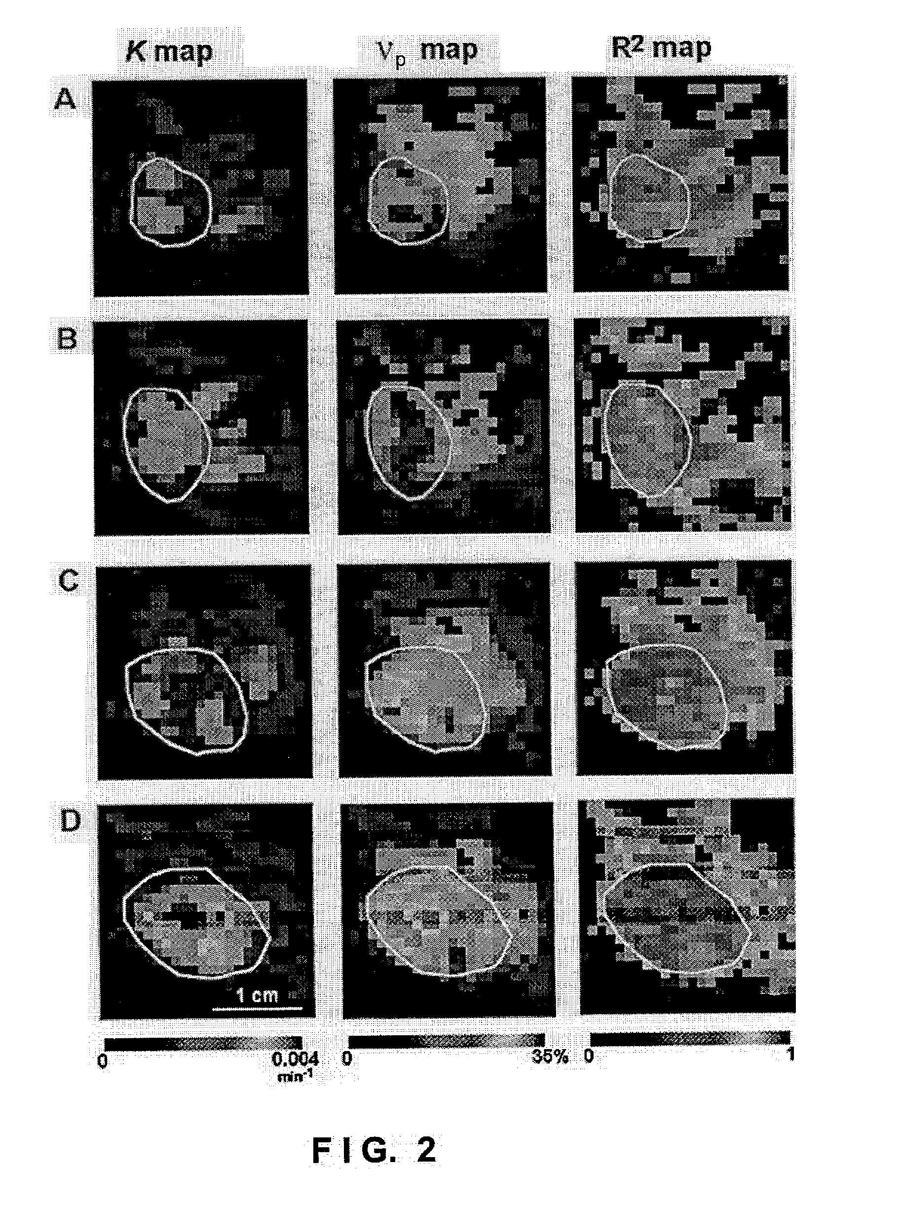 Method and apparatus for monitoring and quantitatively evaluating tumor perfusion