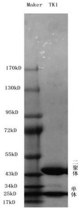 tk1 antibody, kit and use thereof