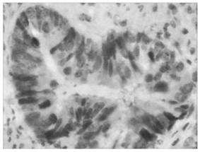 tk1 antibody, kit and use thereof