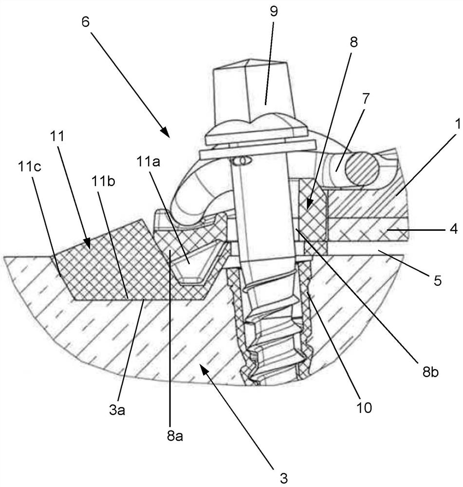 Rail fixing system