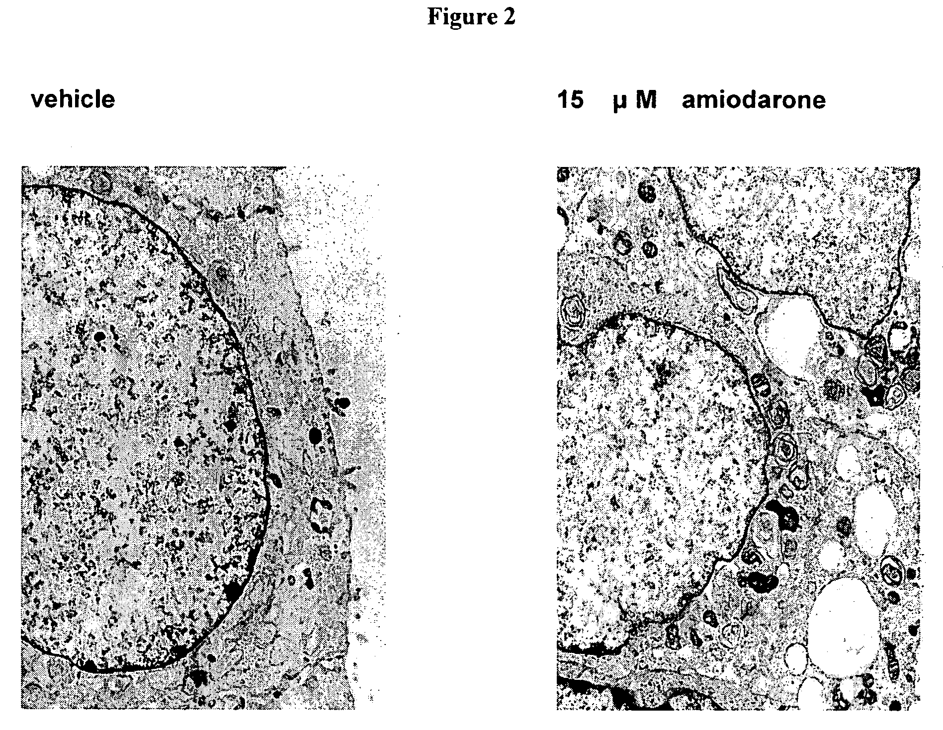 Methods and compositions for using alveolar macrophage phospholipase A2