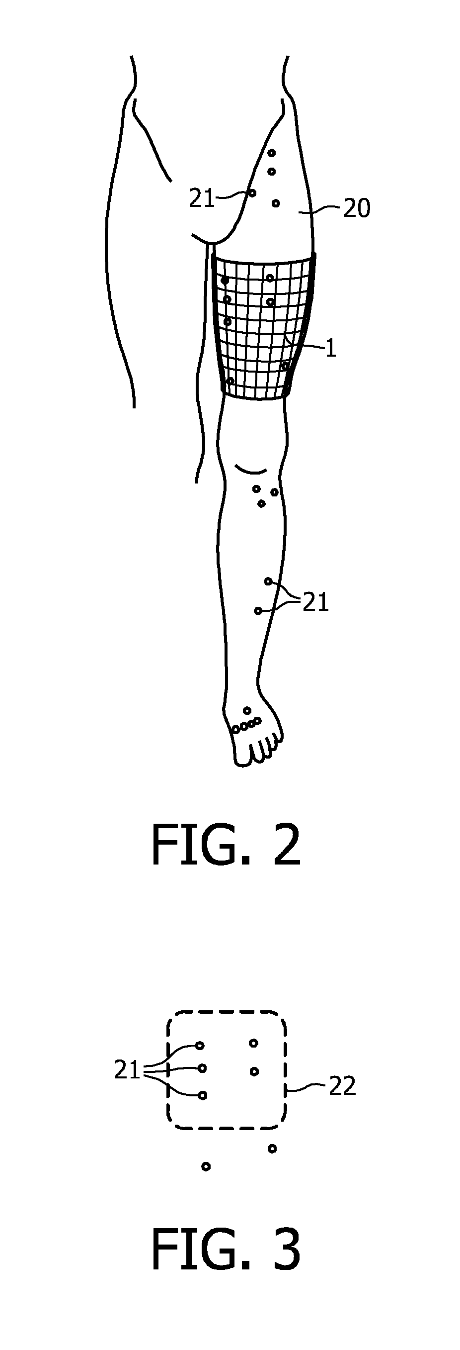 Electrotherapeutic device