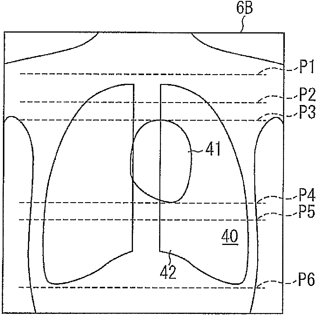 X-ray CT apparatus and image reconstructing device