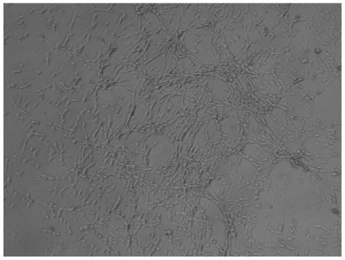Preparation method and storage method for placenta-derived mesenchymal stem cell exosome