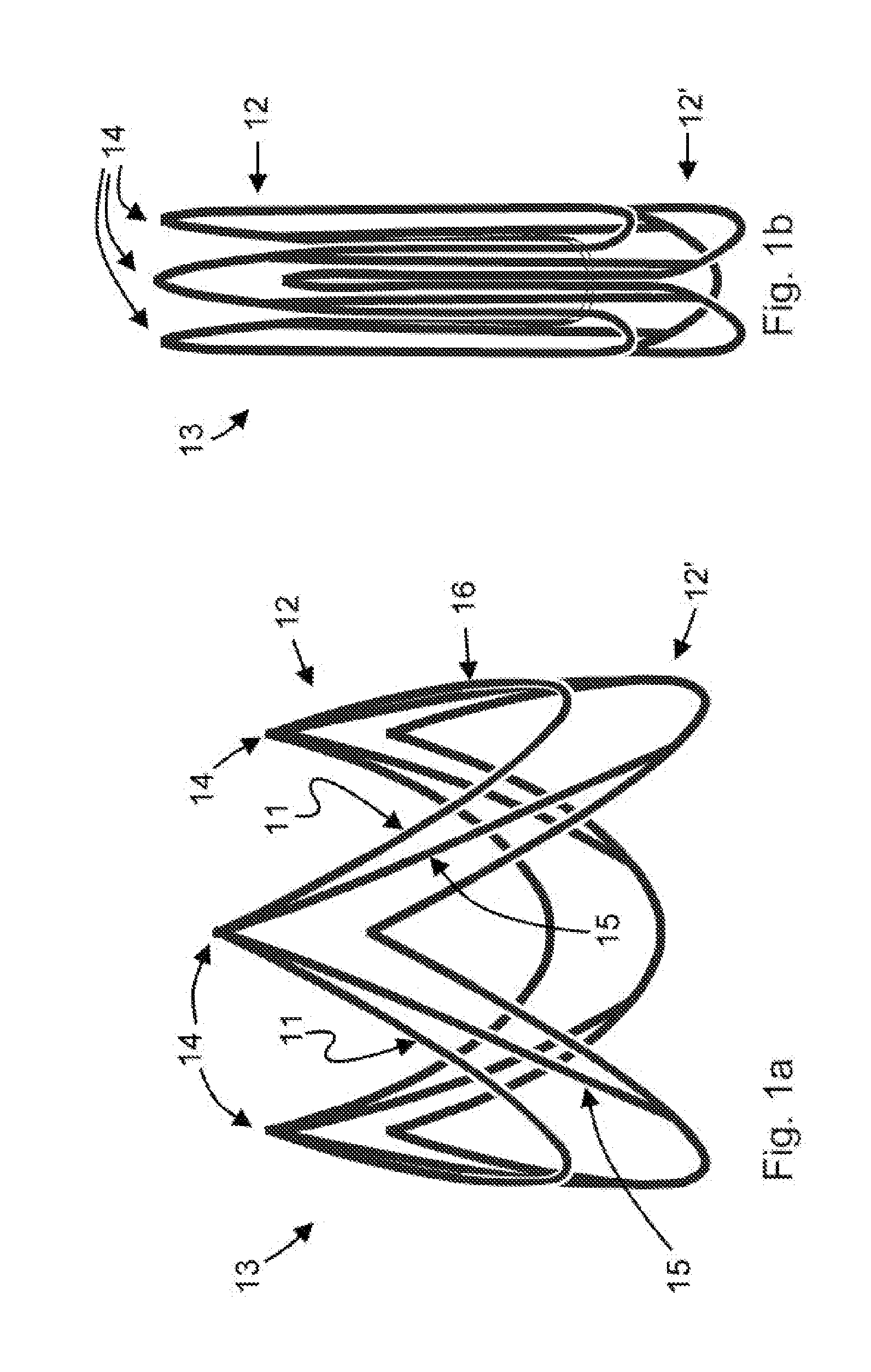 Percutaneously implantable flap stent, device for applying the same and method for producing the flap stent