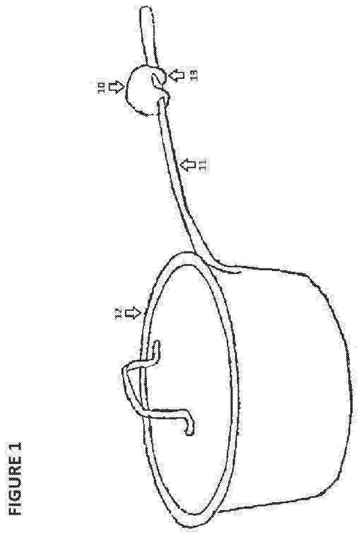 Boiling detection and alert system and method for cooking applications