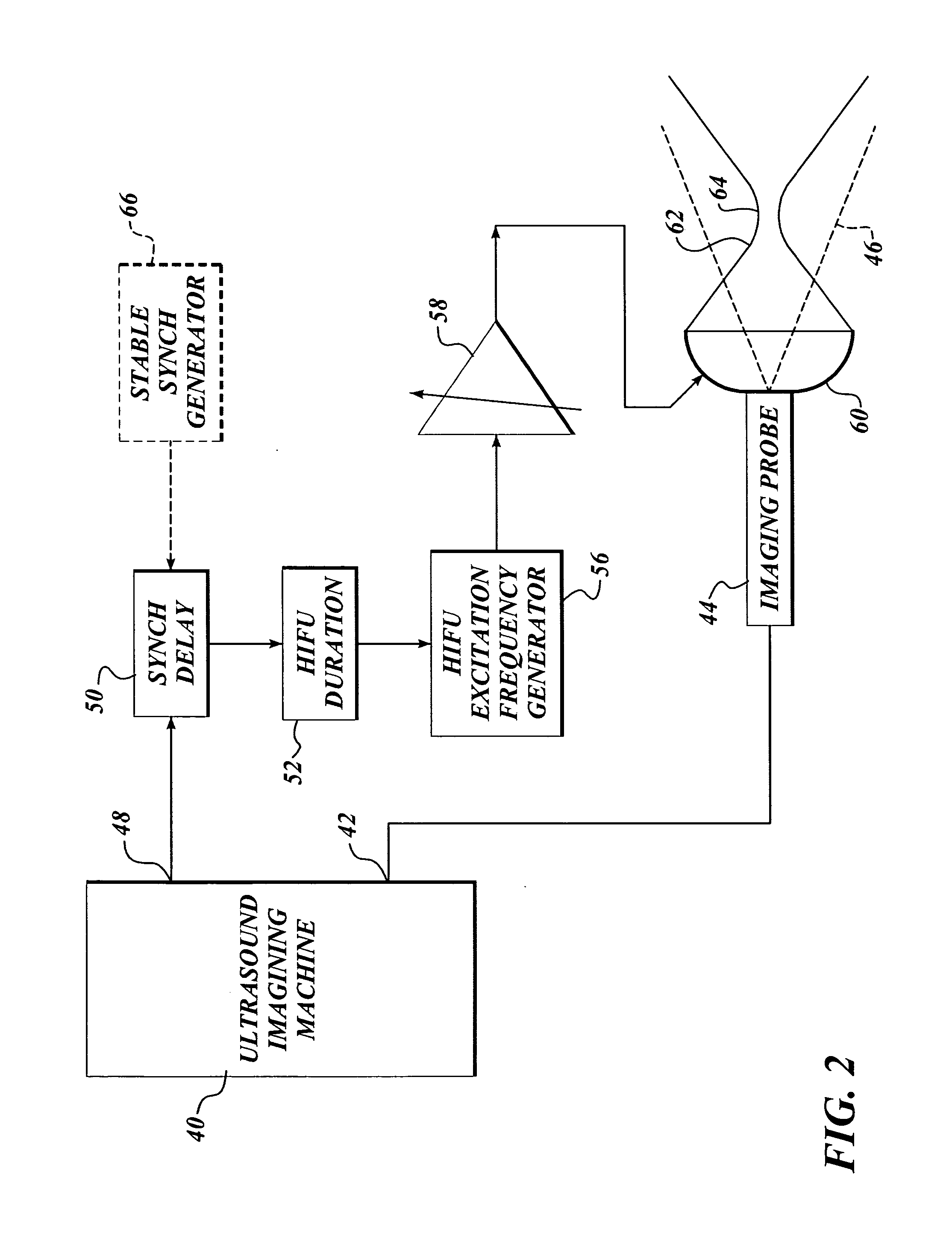 Ultrasound guided high intensity focused ultrasound treatment of nerves