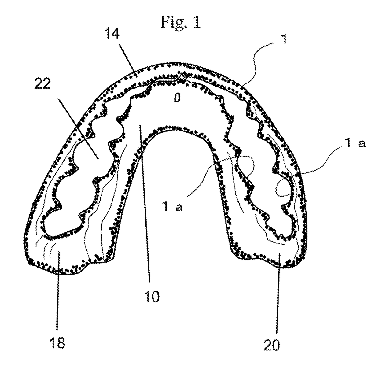 Orthodontic retainer