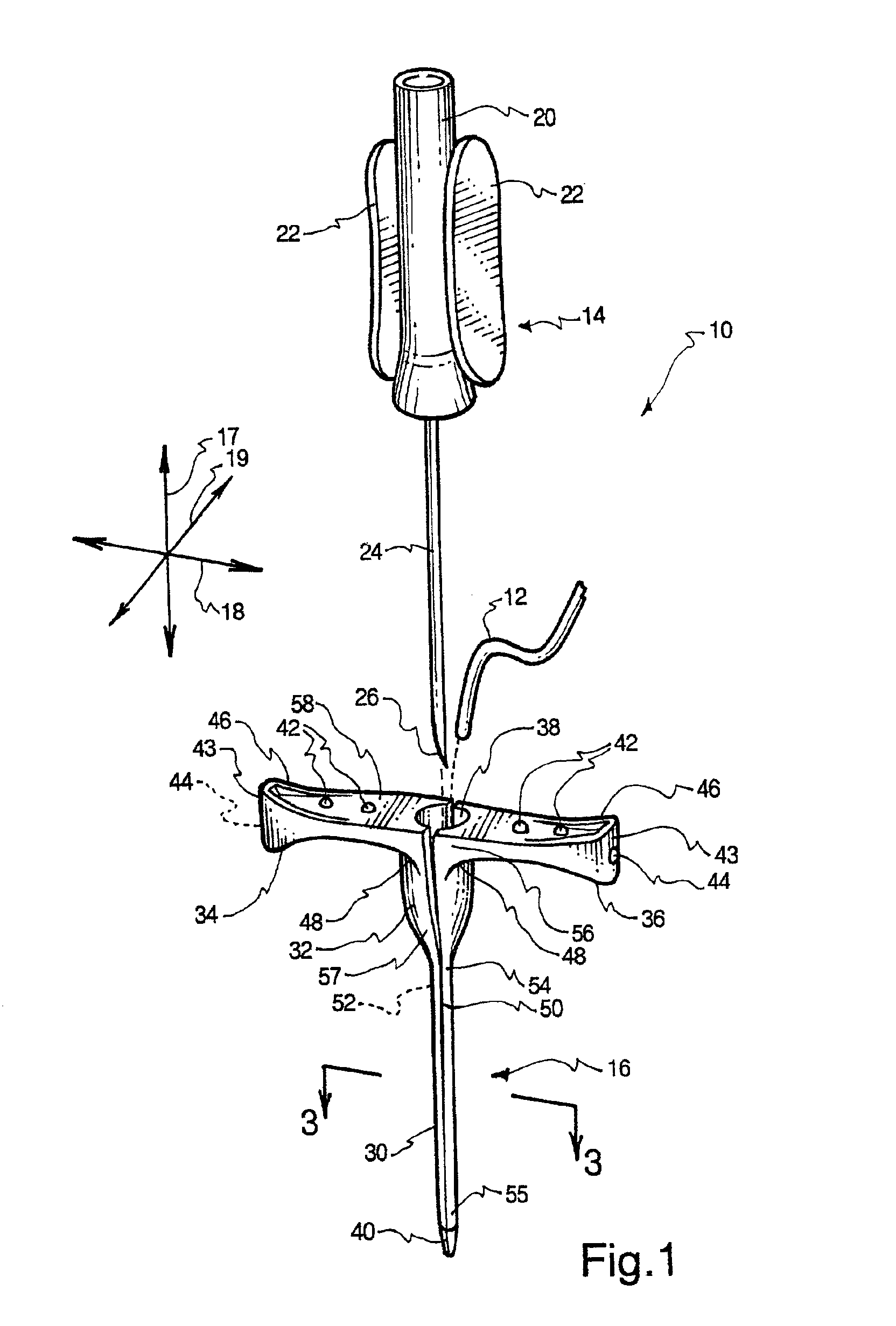 Catheter sleeve assembly and one step injection molding process for making the same