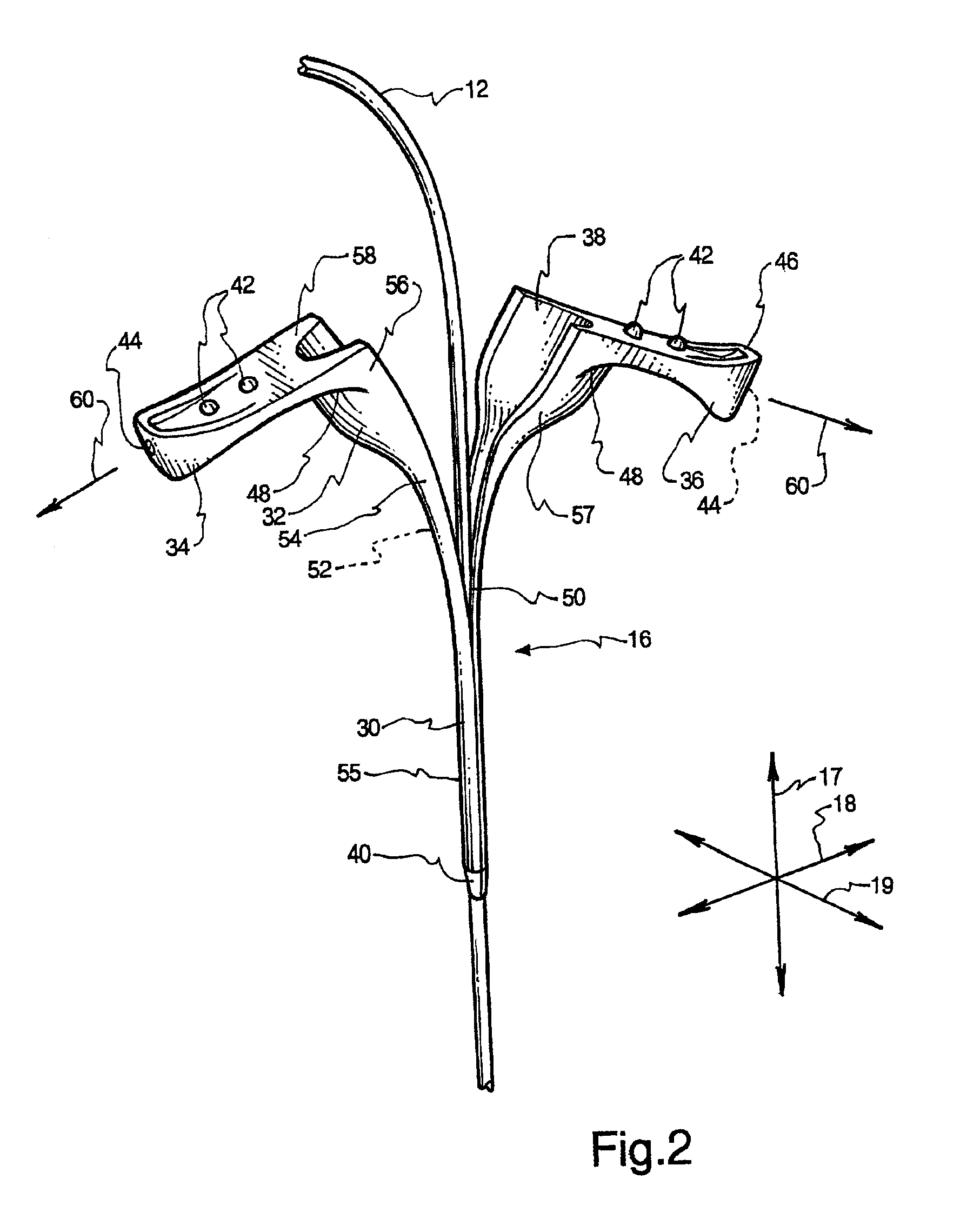Catheter sleeve assembly and one step injection molding process for making the same