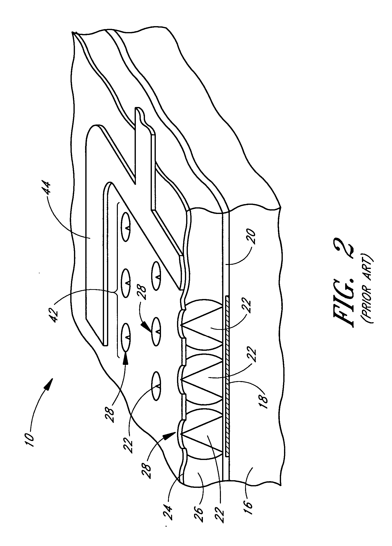 Method of forming nitrogen and phosphorus doped amorphous silicon as resistor for field emission display device baseplate