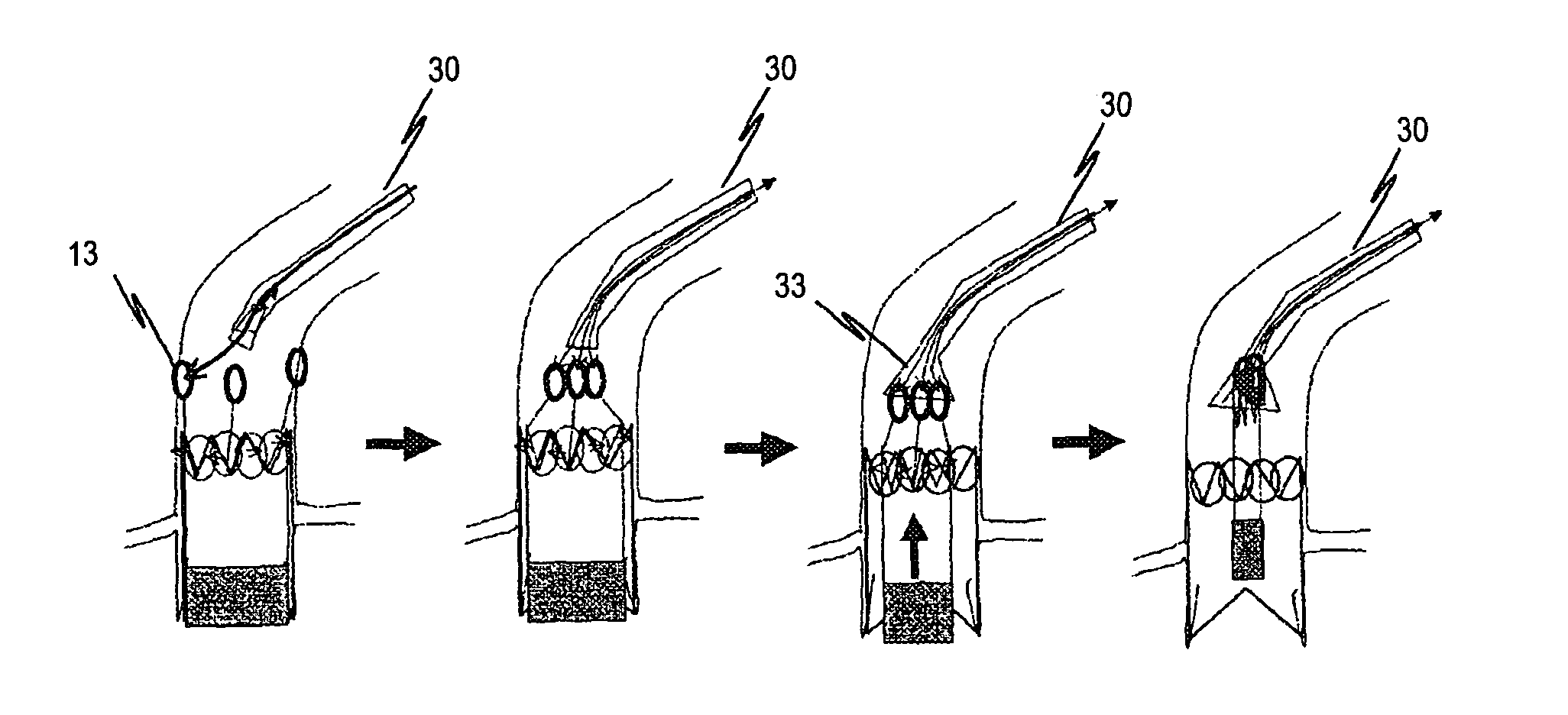 Device for the implantation and fixation of prosthetic valves