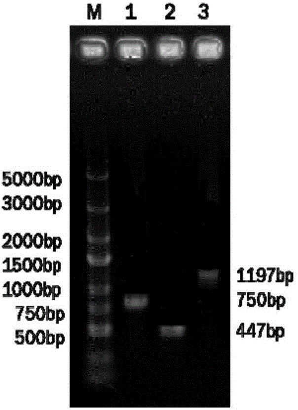 Recombinant adenovirus capable of co-expressing double antibacterial genes of SAL-2 and hLYZ, and construction method and application thereof