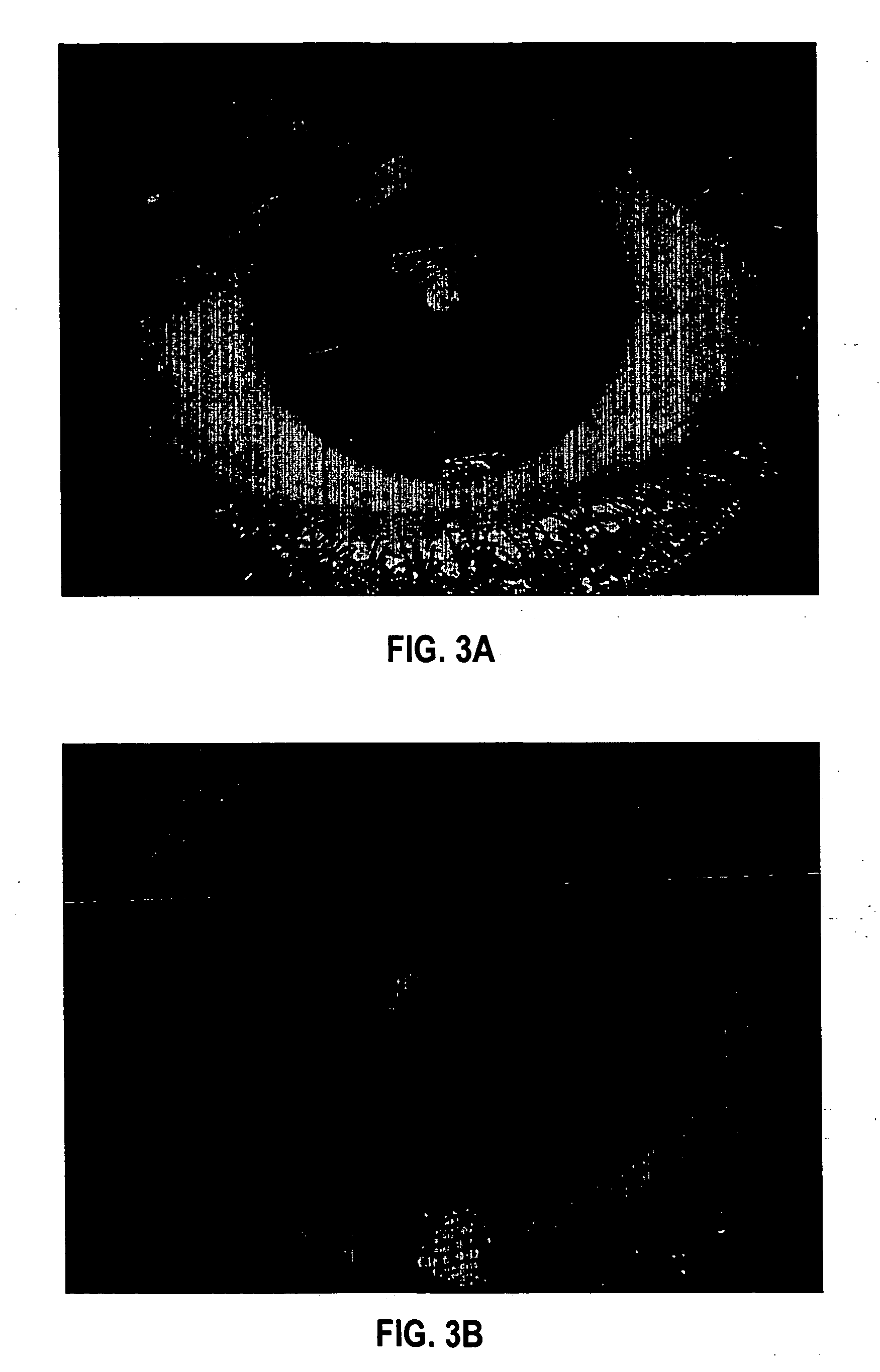Formulation and method for administration of ophthalmologically active agents